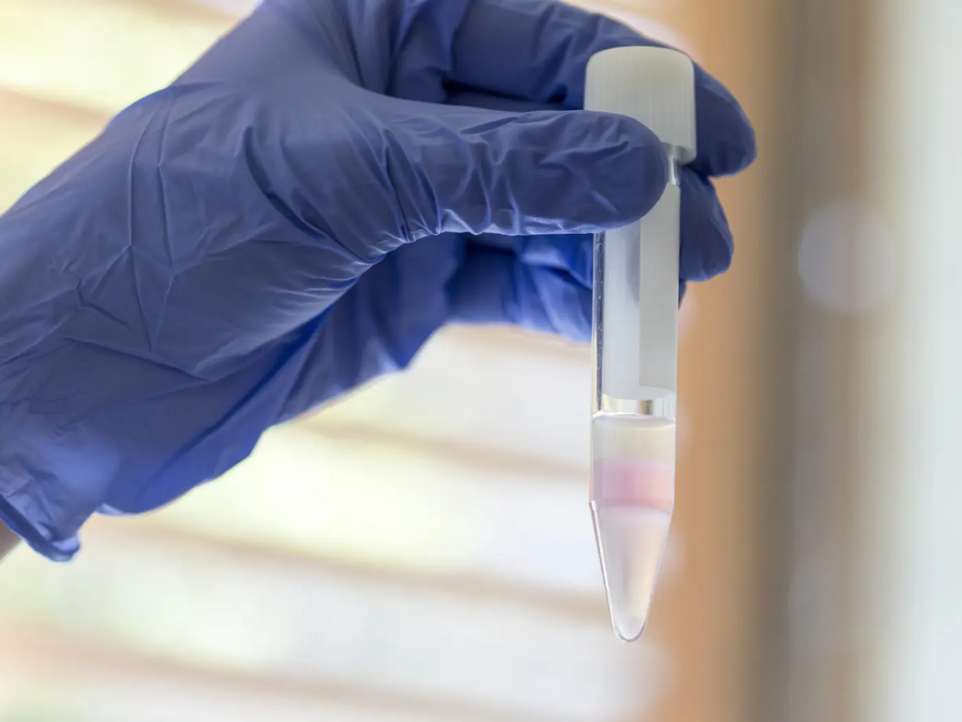Tubo da laboratorio trasparente con tappo bianco, contenente un liquido rosa, tenuto da una mano con guanto blu.